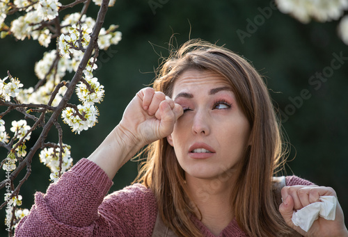 Fotografija GIrl rubbing eyes because of pollen allergy in spring