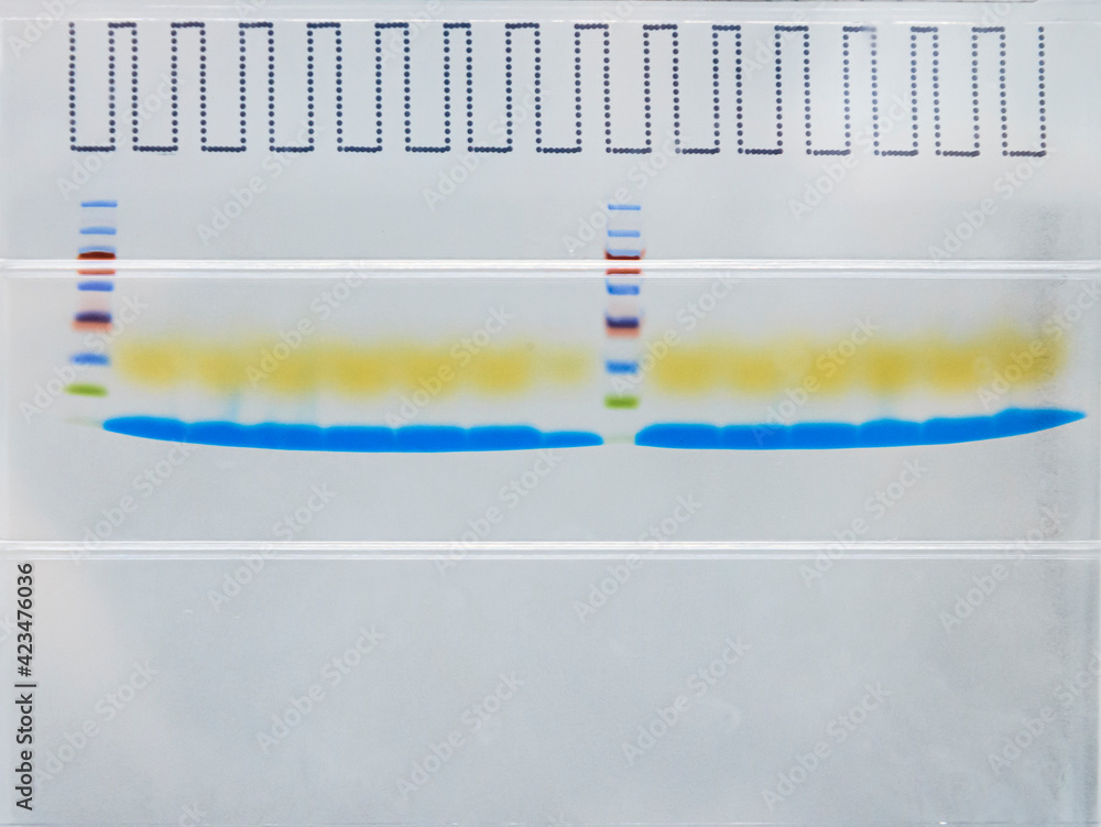 Close up of Protein ladder and protein samples which were separating by molecular mass on SDS-PAGE