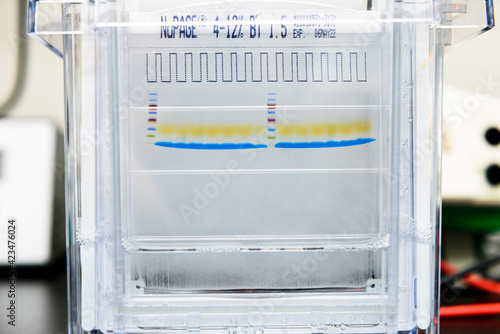 Protein ladder and protein samples on SDS-PAGE for interesting protein separation by mass photo