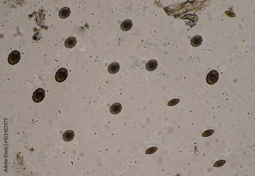 Mixed Ascaris lumbricoides and Trichulis trichiura egg in stool examination. photo