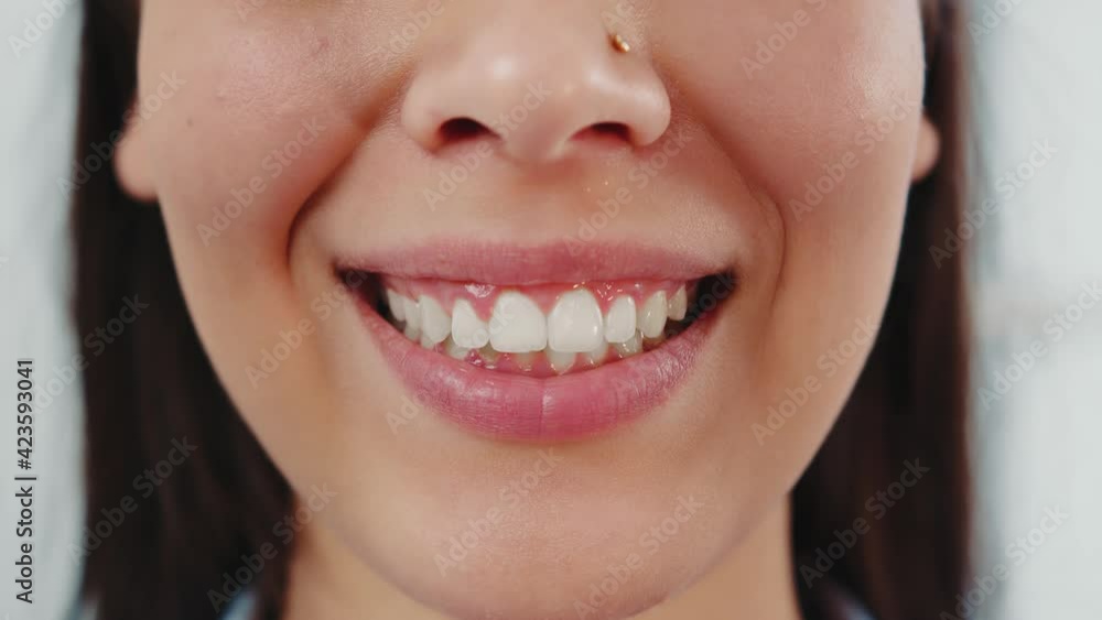 Smile of a charming girl with perfect white teeth close up. Perfect white teeth and a smile. Smile of a charming girl with perfect white teeth close up. Perfect white teeth and a smile.