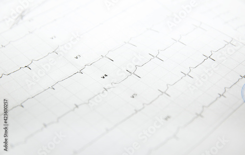 a card with a cardiogram of the heart. High quality photo
