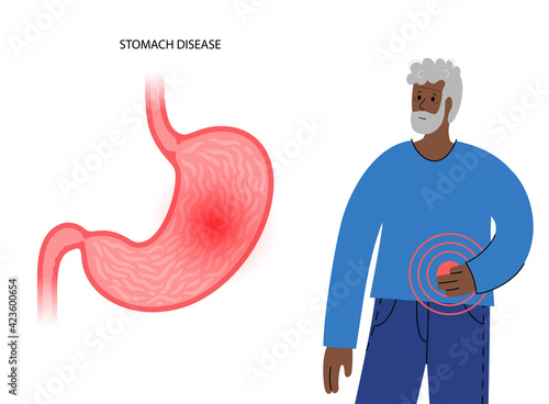 Stomach disease concept