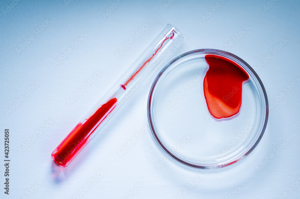 Medical laboratory. A test tube and a Petri dish with blood on a white background. The concept of laboratory research. Medical laboratory. A test tube and a Petri dish with blood on a white background. The concept of laboratory research.