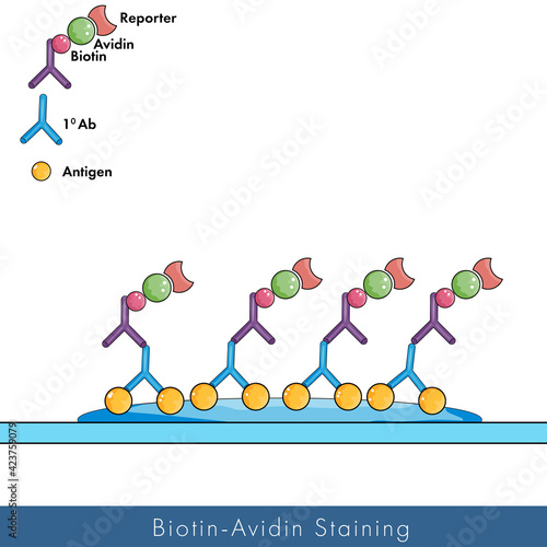 Microscopic view of avidin and biotin interaction on a slide, avidin biotin staining method using antibodies vector