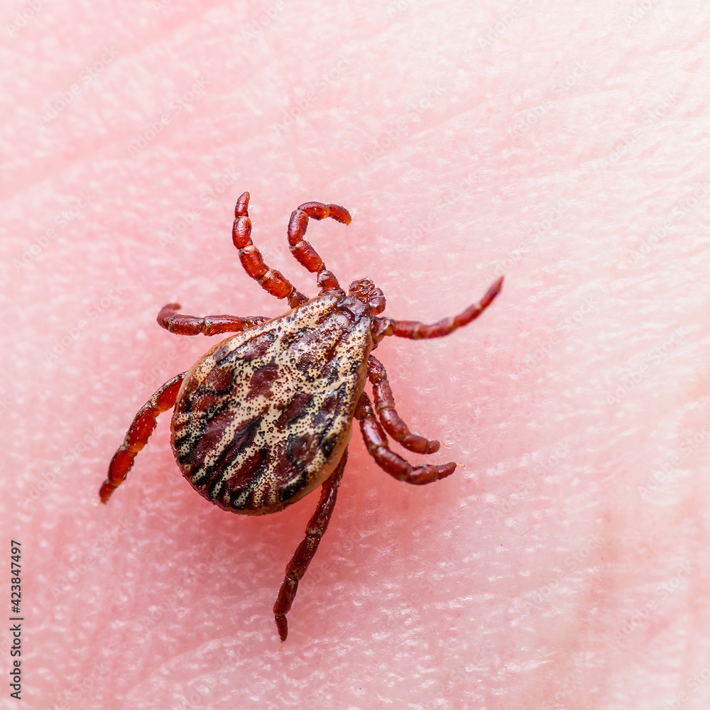 Encephalitis Virus or Lyme Borreliosis Disease Infected Tick Arachnid Insect Crawling on Skin Encephalitis Virus or Lyme Borreliosis Disease Infected Tick Arachnid Insect Crawling on Skin