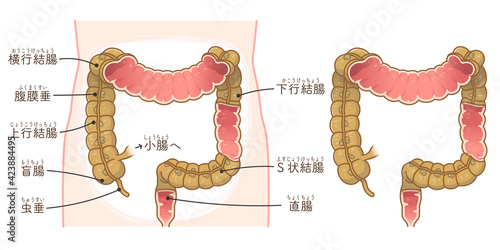 大腸の断面イラスト