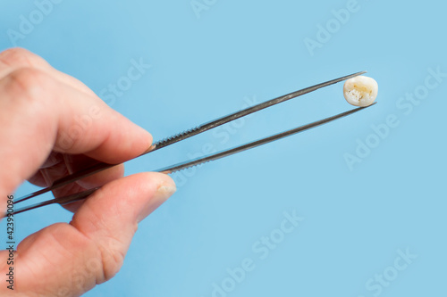 Human hand holding baby tooth in tweezers. Molar in man hand over blue background. Kids an oral hygiene concept with copy space.