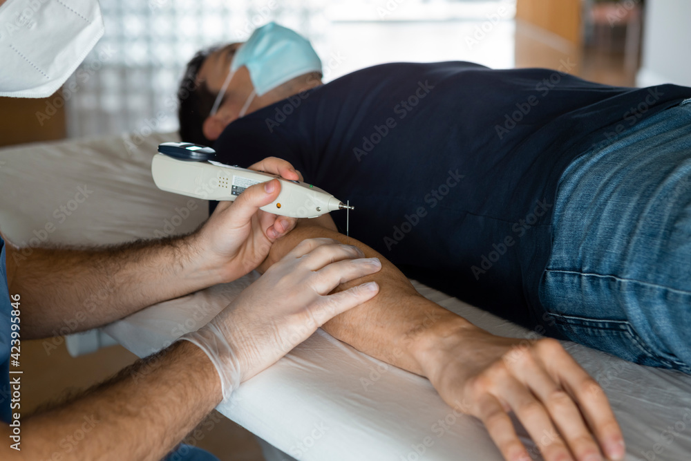 Male patient lying on a stretcher of a health center, receiving a alternative Dry needling treatment for arm injury with electric shock device, done by a physiotherapist during Coronavirus outbreak.