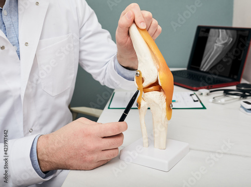 Human cruciate ligament injury treatment concept. Orthopedist showing to cruciate ligament in a knee-joint medical teaching model, close-up photo