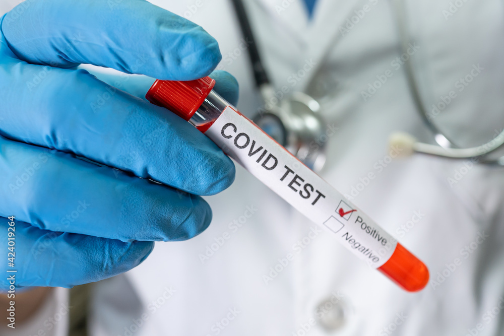 Positive blood infection sample in test tube for covid-19 coronavirus in lab. Scientist holding to check and analyze for patient in hospital. Positive blood infection sample in test tube for covid-19 coronavirus in lab. Scientist holding to check and analyze for patient in hospital.