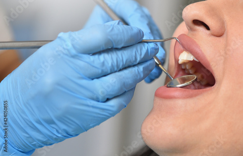 Dentist checks female teeth with dental tools, close-up.