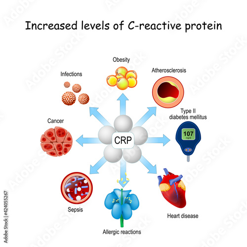 C-reactive protein. crp