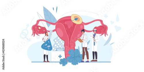 Cartoon flat doctor characters at work,physicians with medical devices in uniform lab coats study uterus reproductive system-human anatomy internal organ desease medical treatment therapy concept