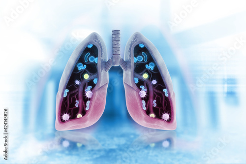 Virus and bacteria infected the Human lungs. lung disease.3d render