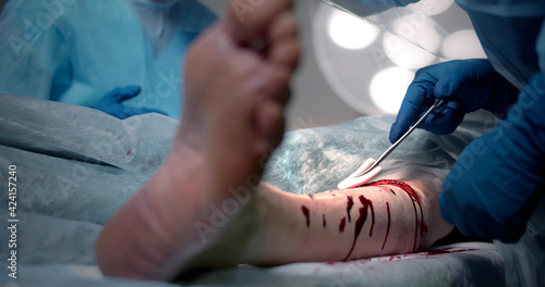 Cropped shot of surgeon holding sponge cleaning wounded leg of patient