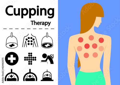 Hijama or Cupping Therapy Icons in flat vector art