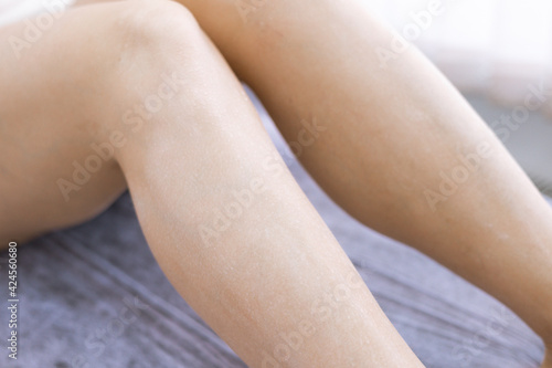 female legs before hair removal with  sugaring procedure in beauty salon