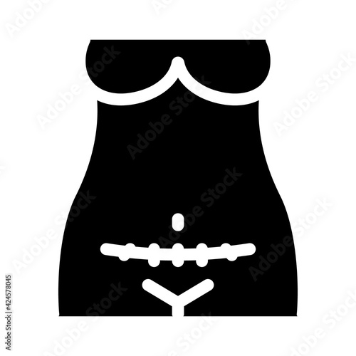 cesarean section glyph icon vector. cesarean section sign. isolated symbol illustration