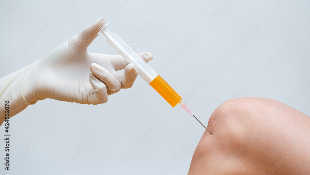 Doctor doing stem cell therapy on a knee with platelet-rich plasma injection.