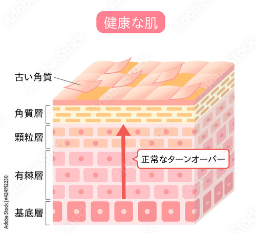 ターンオーバー　断面図　立体