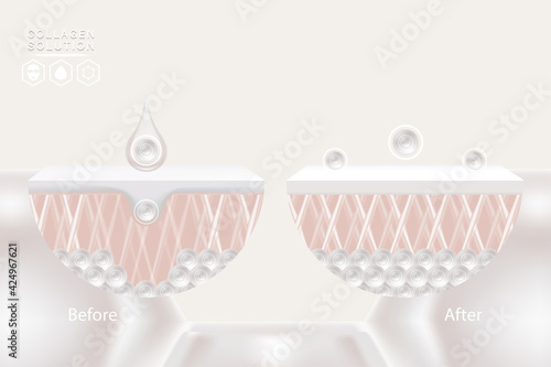 Hyaluronic acid before and after skin solutions ad, white collagen serum drops with cosmetic advertising background ready to use, illustration vector.