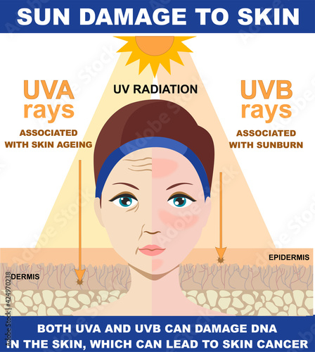 Sun damage to skin.The difference of radiation 2 types in sunlight which is harmful to the skin. Infographic of difference between UVA and UVB rays. UV penetration into human skin and woman face.