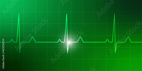 elettrocardiogramma, onda, cuore, scienza, biologia 