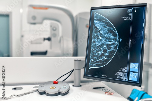 Mammogram snapshot of breasts of a female patient on the monitor with undergoing mammography test on the background. Mammography test at the hospital. Medical equipment. photo