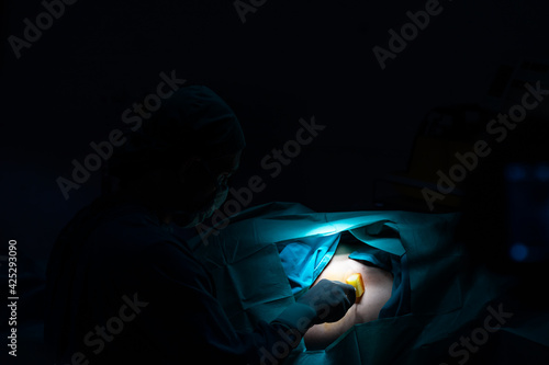 Medical Team Performing Surgical Operation in Operating Room. Doctor and team have skilled and recognized.