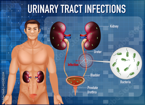 Information poster of urinary tract infections