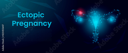 Ectopic Pregnancy concept. Female reproductive system, uterus organ, on dark blue background. Obstetrics and Gynecology concept. Abstract low poly wireframe style. Vector illustration.