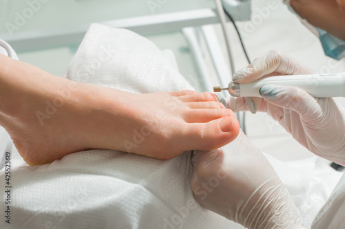 A Podiatrist doctor who takes care of a woman's toenails. Cosmetic procedures of the feet