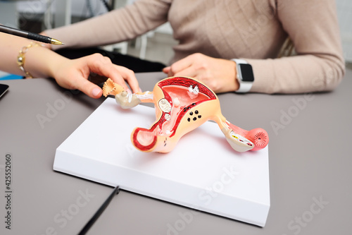 model of a human uterus in the hands of a gynecologist close-up. Women's consultation photo