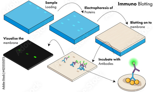 Immunoblotting (western blotting) in biochemical analysis of proteins using gel electrophoresis.