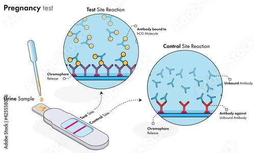 illustration of steps of pregnancy test kit working.