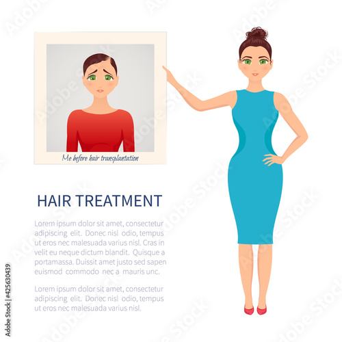 Woman with photo before and after hair loss treatment on white background. Female baldness solution. Alopecia infographic medical design template. Clinic concept design. Vector illustration.