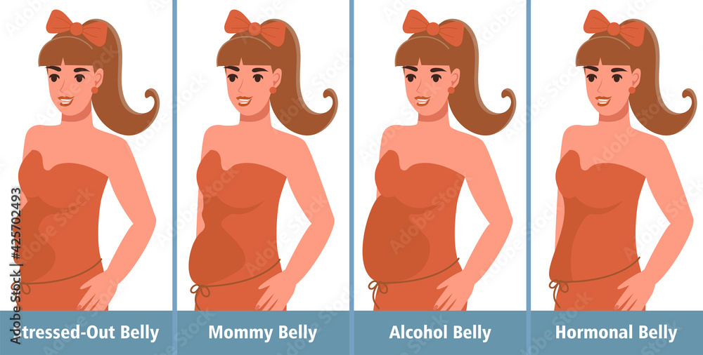 Types of Tummies for women. Overweight woman. Postpregnancy