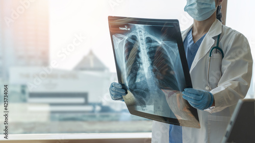 Lung disease, covid-19, asthma or bone cancer illness with doctor diagnosing patient’s health with radiological chest x-ray film for medical healthcare hospital service photo