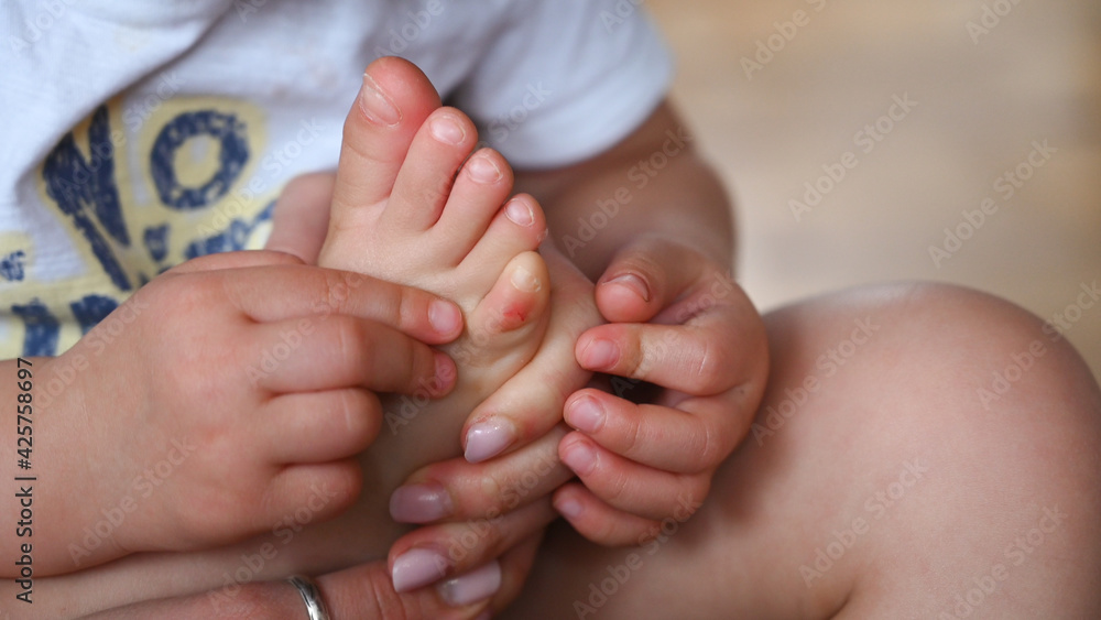 Callus on a child's foot. Child health problems concept. Stock Photo