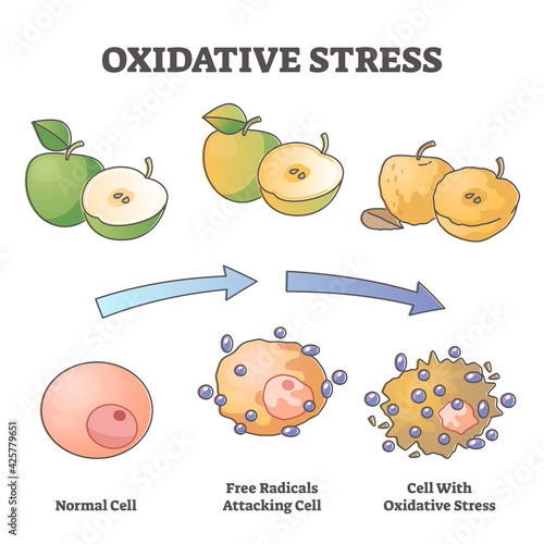 Oxidative stress aging as free radical cell attacking process outline diagram