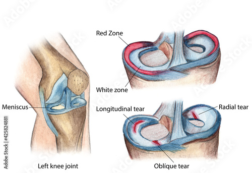 anatomy of the human knee meniscus tears
