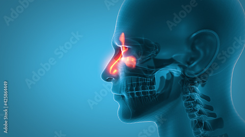 3d illustration of human head whith sinusitis. photo
