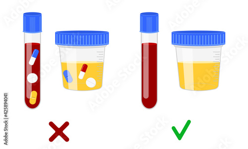 Blood and urine samples with and without different drugs. Doping control in sport, post accident drug testing concept. Vector cartoon illustration.
