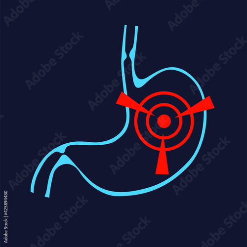 Stomach heartburn. Stomach pain, gastritis, indigestion, vomiting, heartburn problems. Heartburn and Gastritis isolated. The concept with indigestion and stomach pain problems. Vector flat