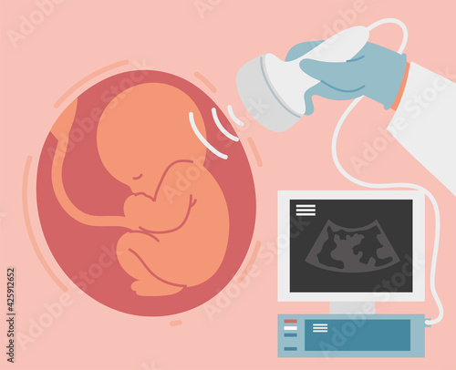 ultrasound scan of baby