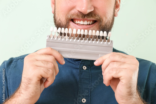 Young man with teeth color ...