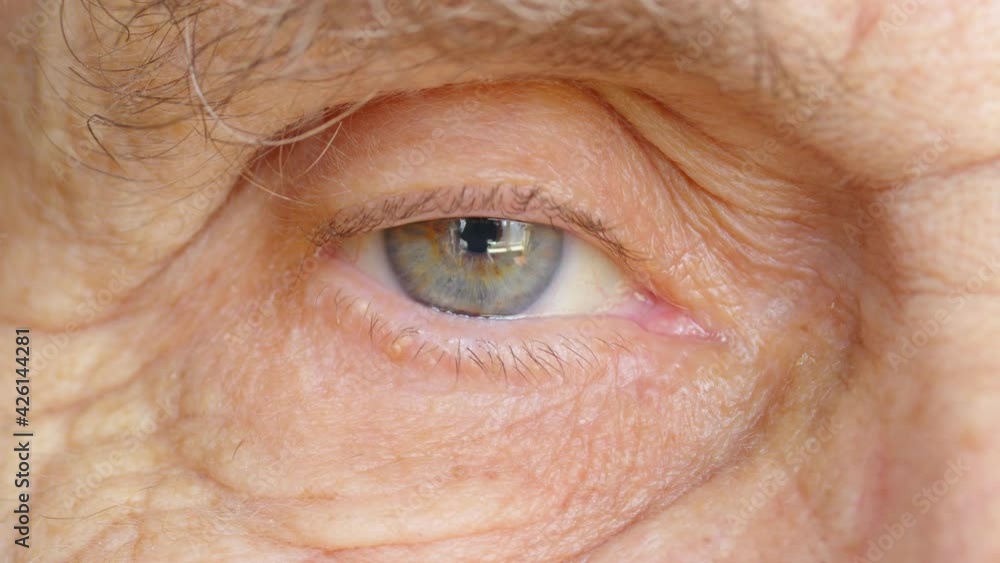The eye of a very old man, close-up. The eye of a very old man, close-up.