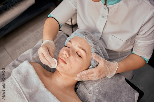 A female cosmetologist cleanses the client's face with acne with cotton pads. Professional beauty salon.