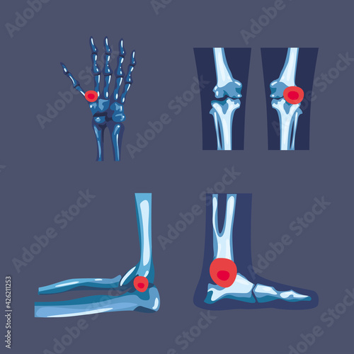 Rheumatology symbol set